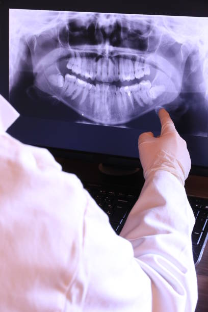 Best Tooth Infection Emergency Dentist  in Otsego, MI